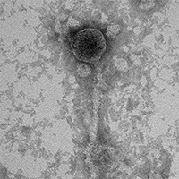 Dolosoccus EM Picture