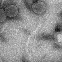 Thumbnail for Demasiado