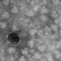 Thumbnail for Weiler