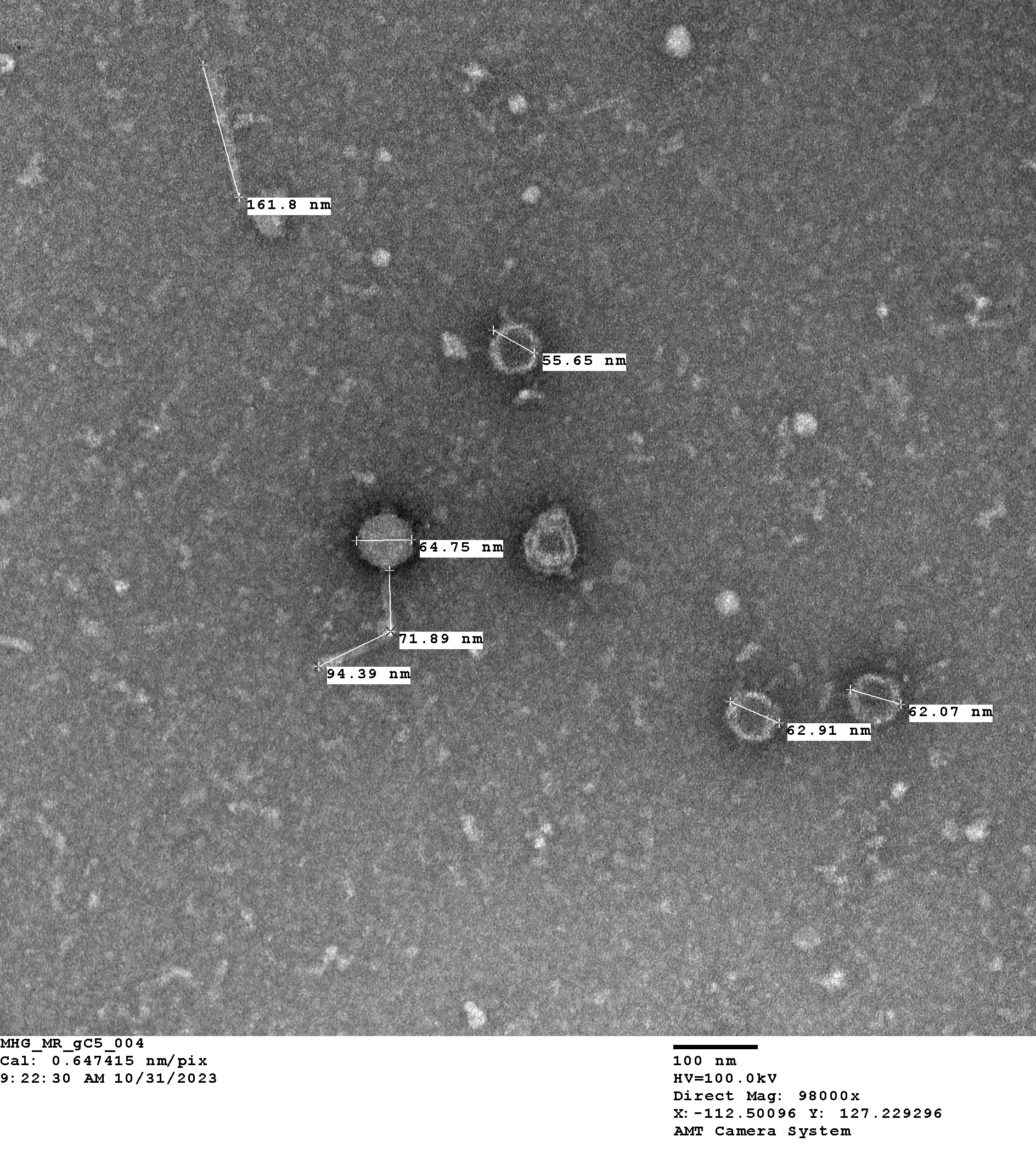 The Actinobacteriophage Database Phage Kunai
