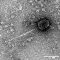 Thumbnail for LindyLou