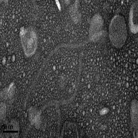 Thumbnail for Chispa