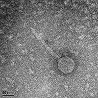 RomansRevenge EM Picture