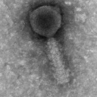 Thumbnail for RunningOnE