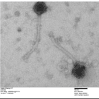 Thumbnail for Asterisk