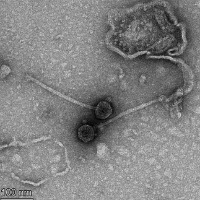 Chandeano EM Picture