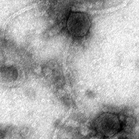 ToasterStrood EM Picture