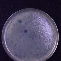 Desmet Plaque Picture