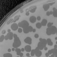 Androme Plaque Picture