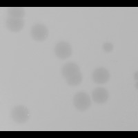 Asterisk Plaque Picture