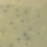 Thumbnail for Phillyphantom