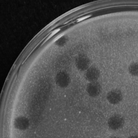 MegTheThird Plaque Picture