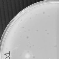 MicyPS Plaque Picture