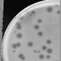 BeBeRex Plaque Picture