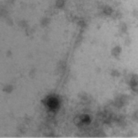 Thumbnail for Wallaby