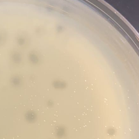 Bakterminator Plaque Picture
